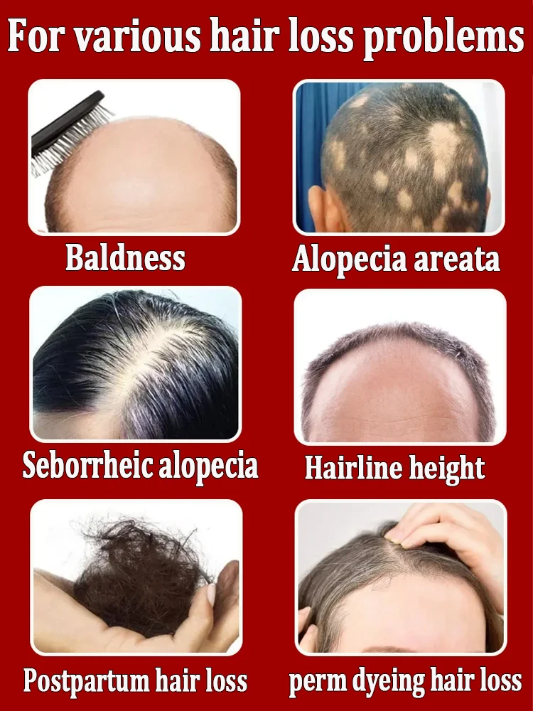 The most effective hair growth essential oil